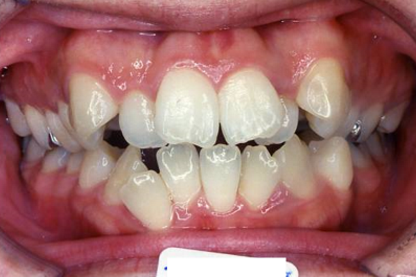 Before image