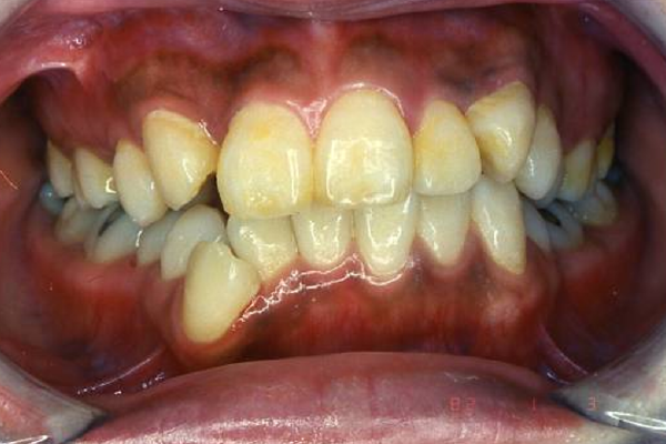 Before image