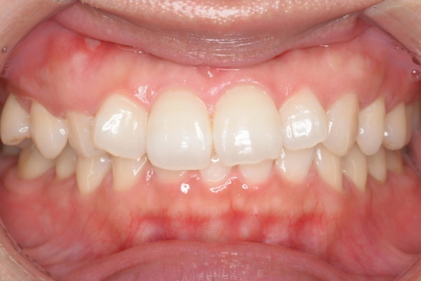 Before image